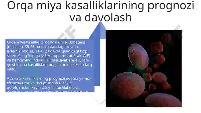 Orqa miya patologiyasi 4