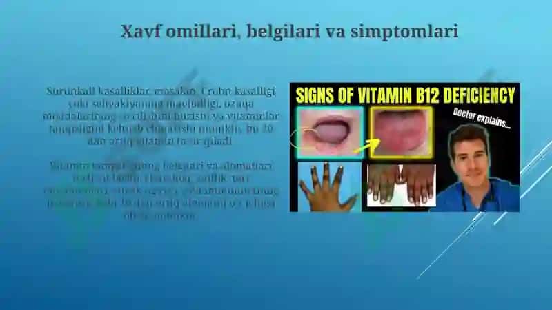 Vitaminlar yetishmovchililgi 4