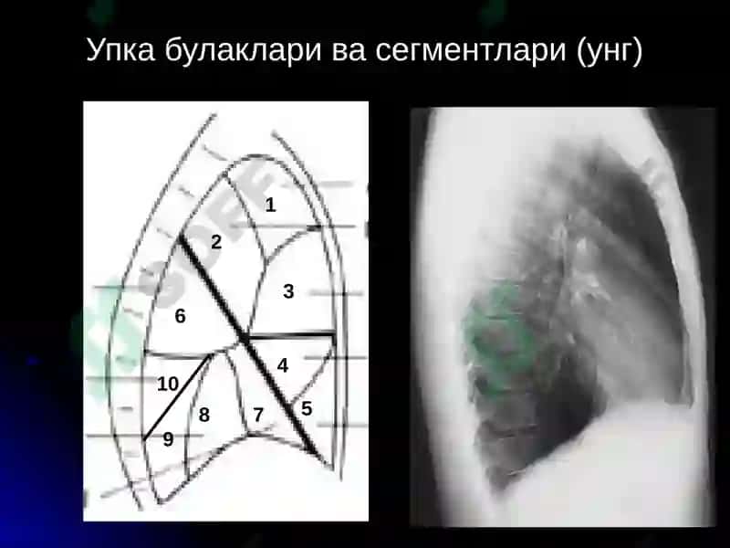 УПКА КАСАЛЛИКЛАРИНИНГ НУР ТАШХИСИ 4