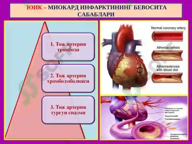 ЮРАК ИШЕМИК КАСАЛЛИГИ - ЮИК 4