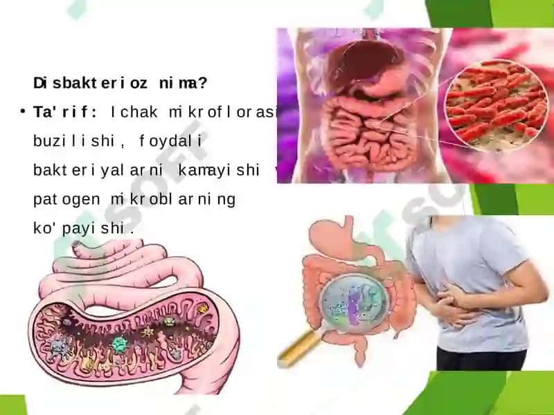 Disbakteriozning ta’rifi 4