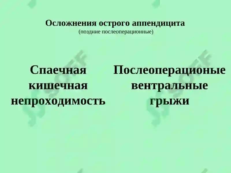 Осложнения острого аппендицита 4