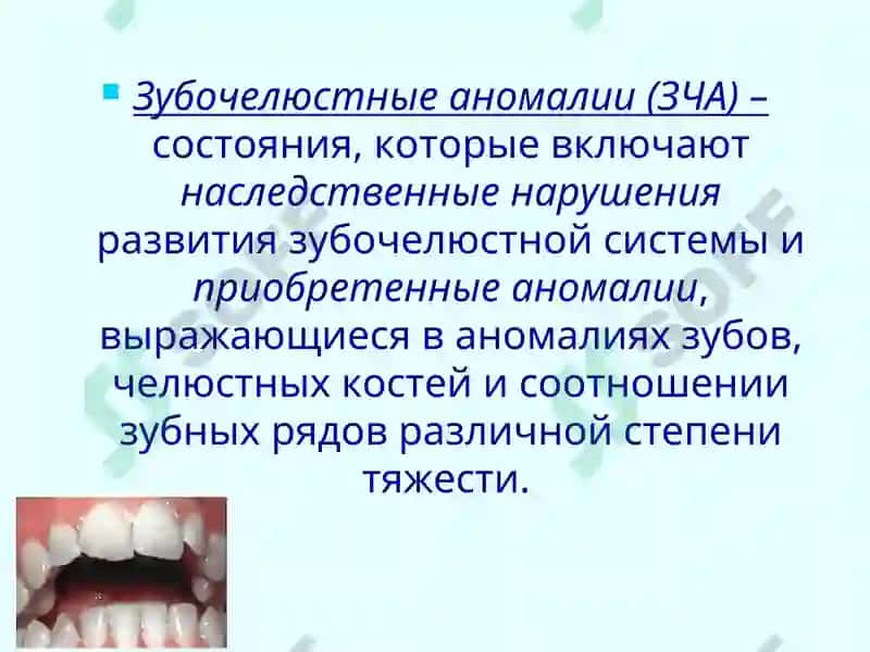 Профилактика зубочелюстных аномалий 4