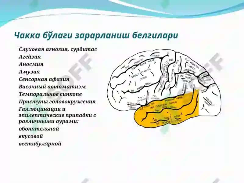 Бош мия ўsmалари 4