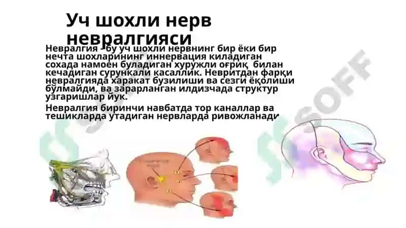 Учшохли нерв 4