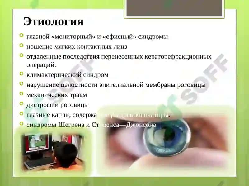 Синдром сухого глаза 4