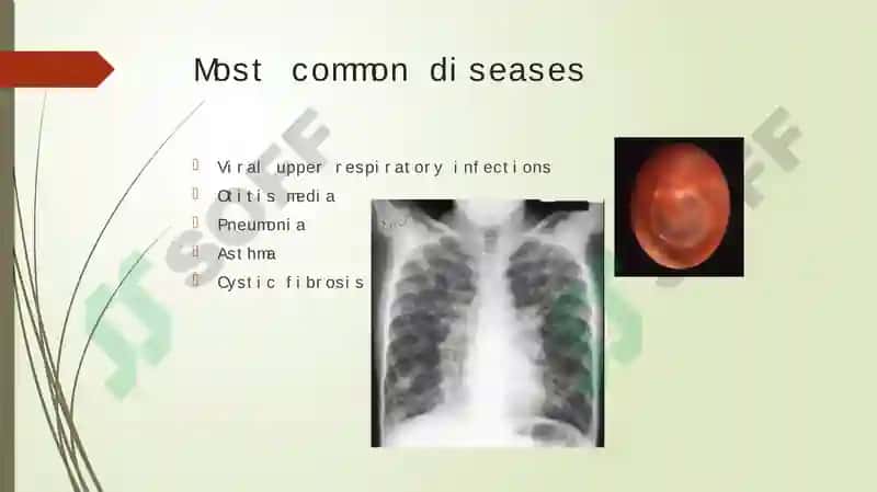 Diseases of the respiratory tract 4
