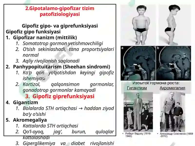 ENDOKRIN TIZIMI PATOFIZIOLOGIYASI 4