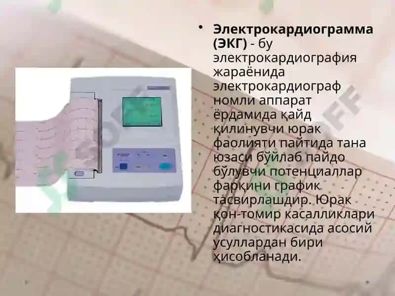 EKG ni yozib olish 4