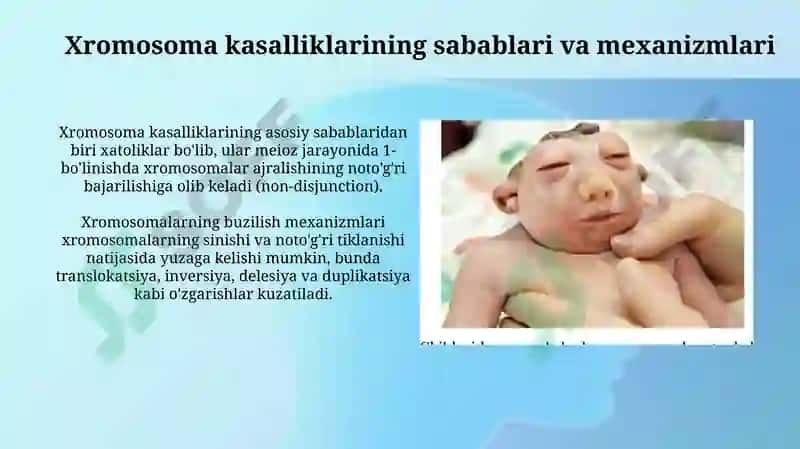 Xromosoma kasalliklari 4