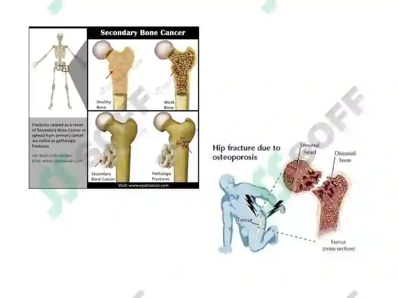 Fracture Management and Primary Care 4