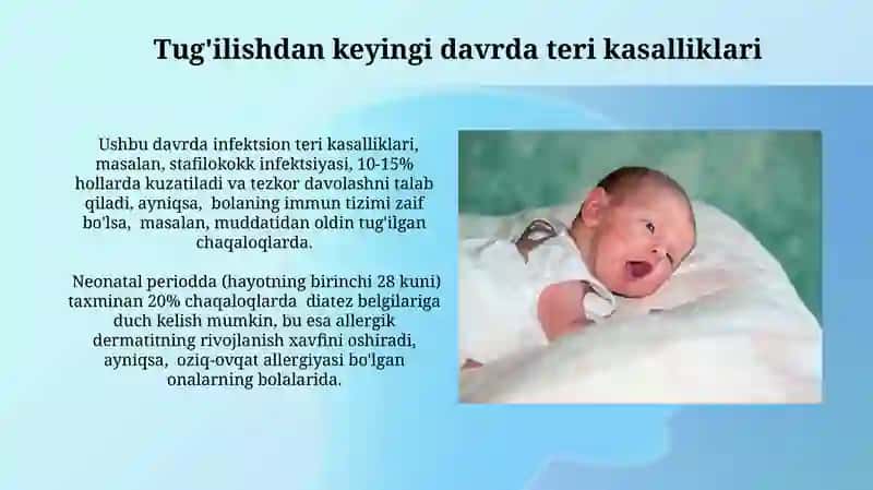 Chaqaloqlik davri kindik va teri kasalliklari 4