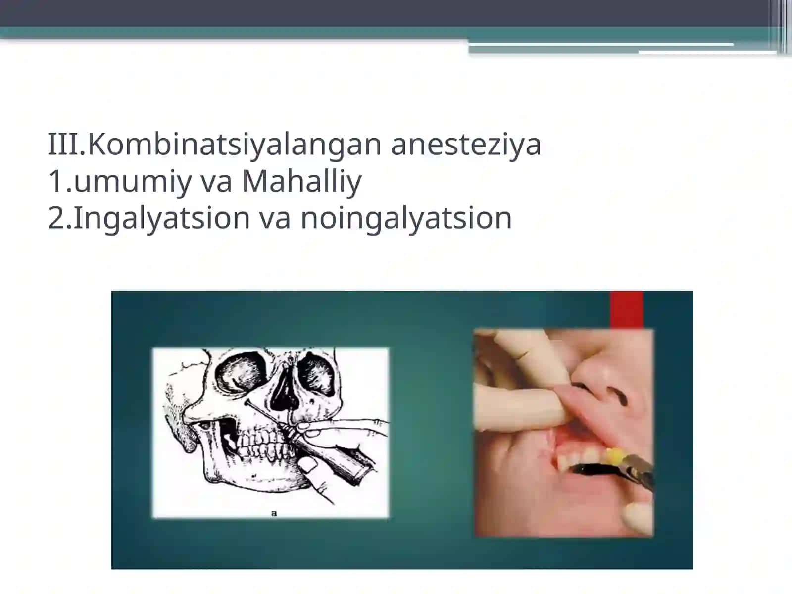 Zamonaviyanesteziyaturlari 4