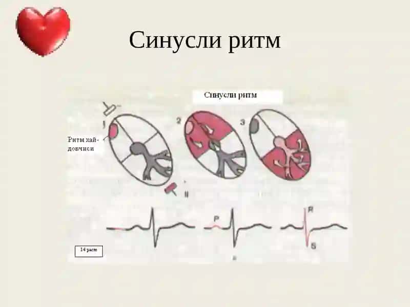 Юрак аритмиялари 4