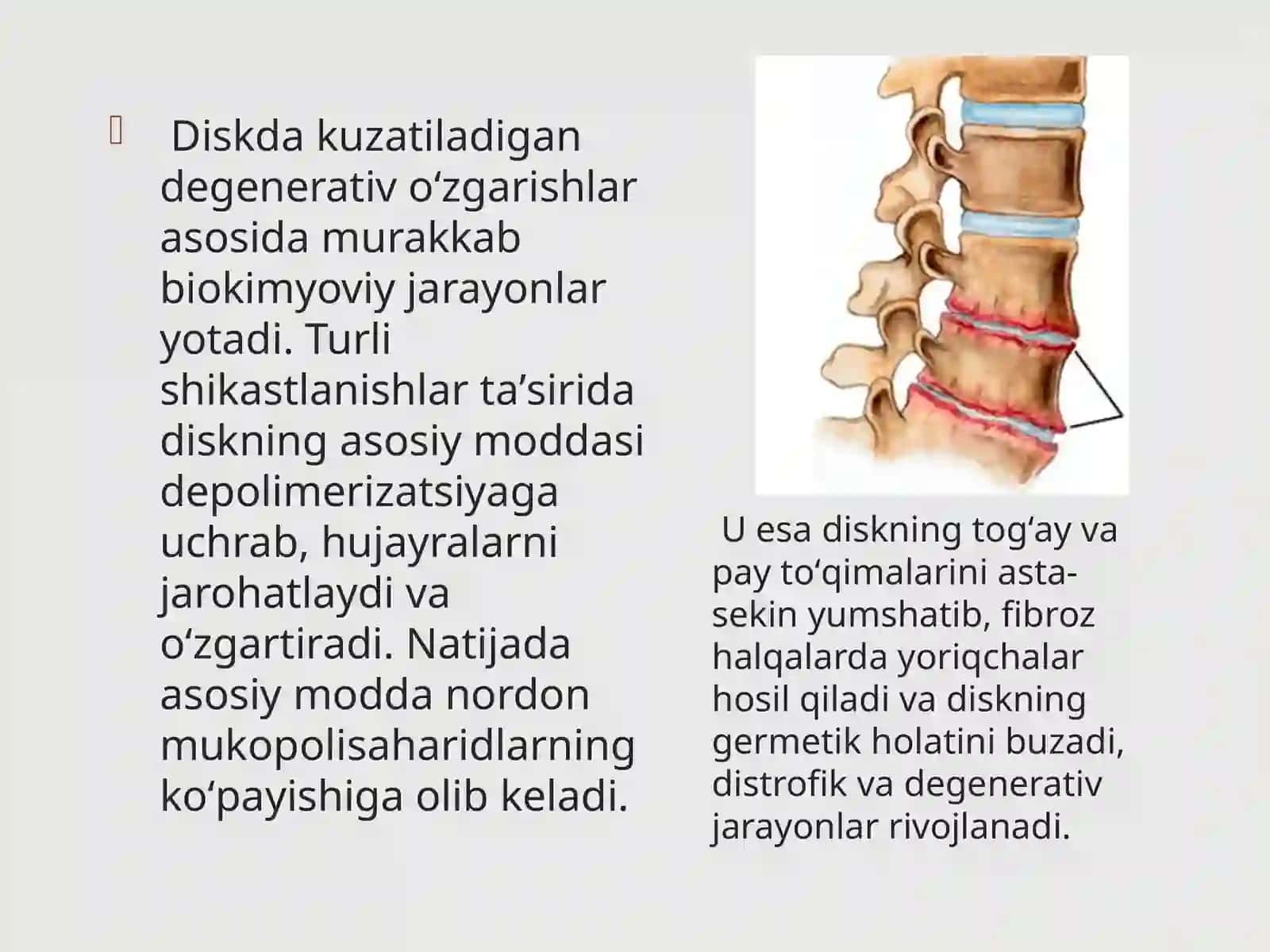 Osteoxondroz 4
