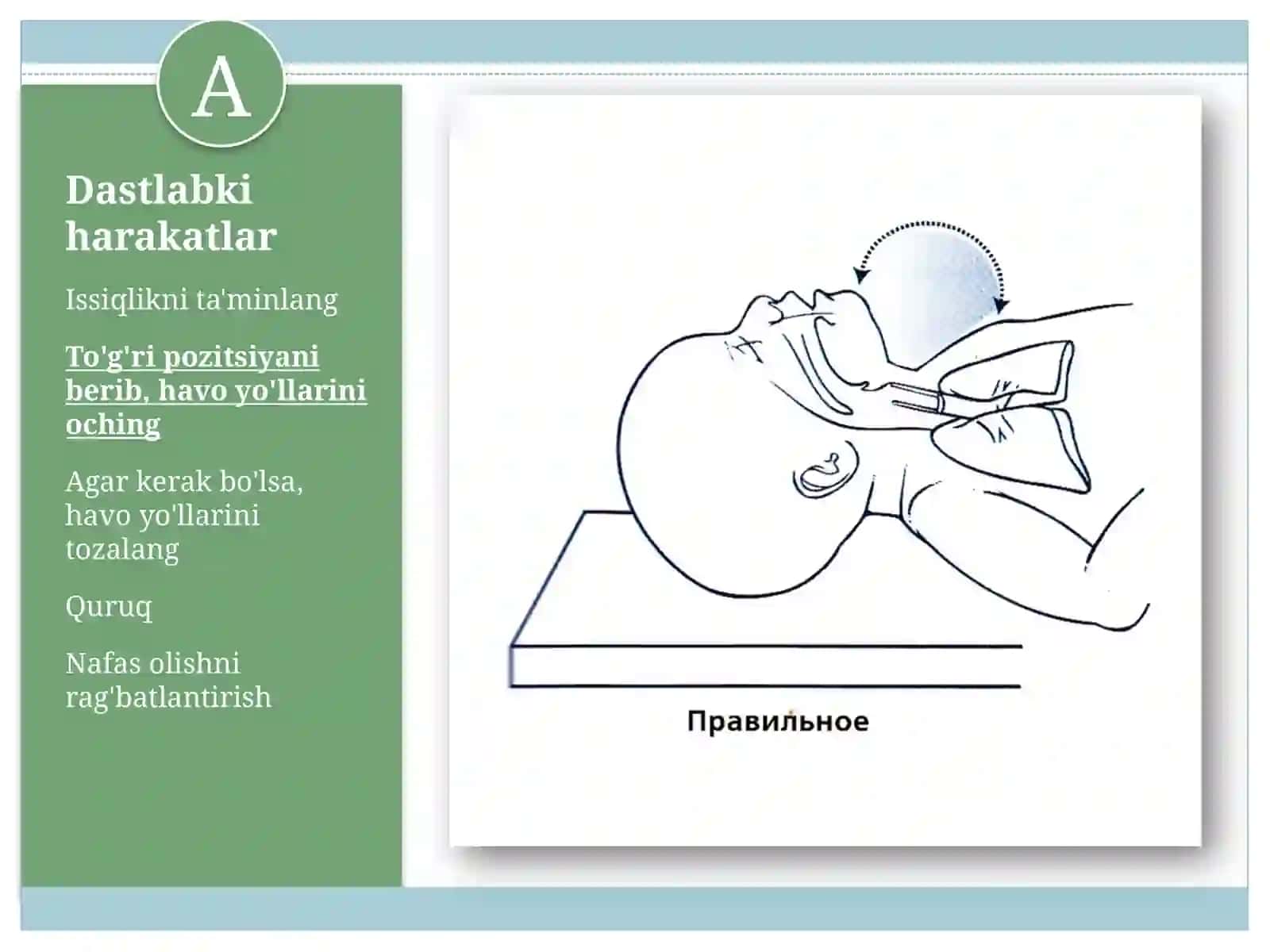 Neonatal reanimatsiyaning asosiy tamoyillari 4