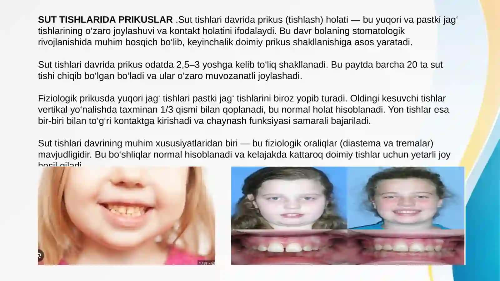 Sut tishlari davrida prikuslar holati 4