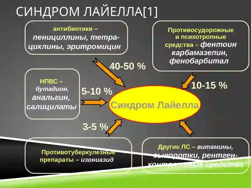 Синдром Лайелла 4