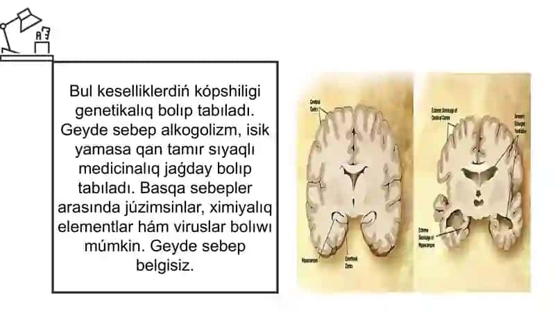 Patologik anatomiya Nerv Degenerativ kasalliklari 4