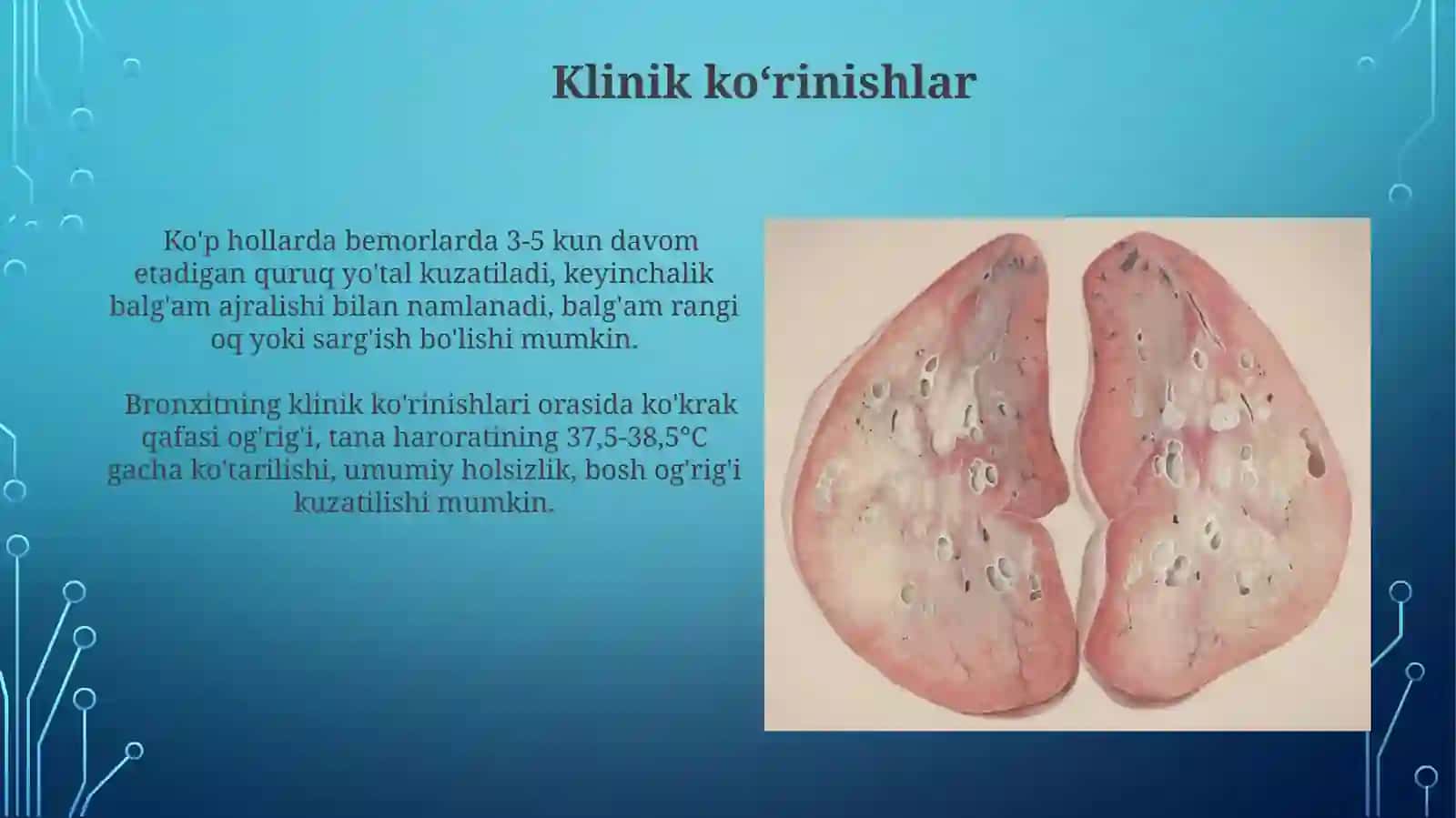 Bronhit kasalligining qo‘zg‘atuvchilari, patogenezi va laboratoriya tashhisi 4