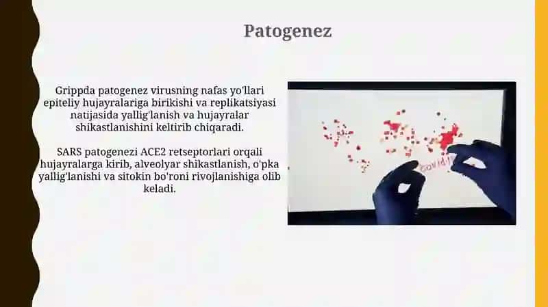 Grip.OʻRVi.Miningakok.Etialogiyasipatogeneziklinikasivaasorati 4