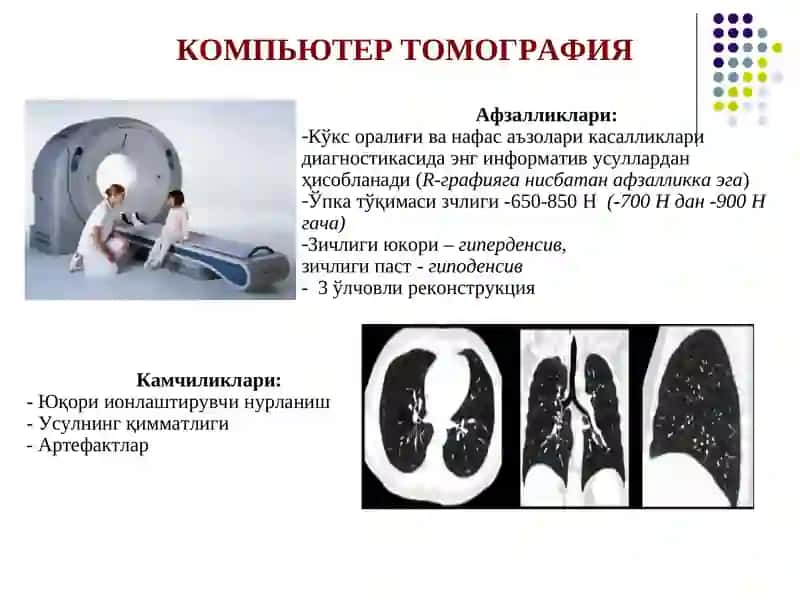 Нафас тизими аъзоларининг тиббий визуализацияси 4