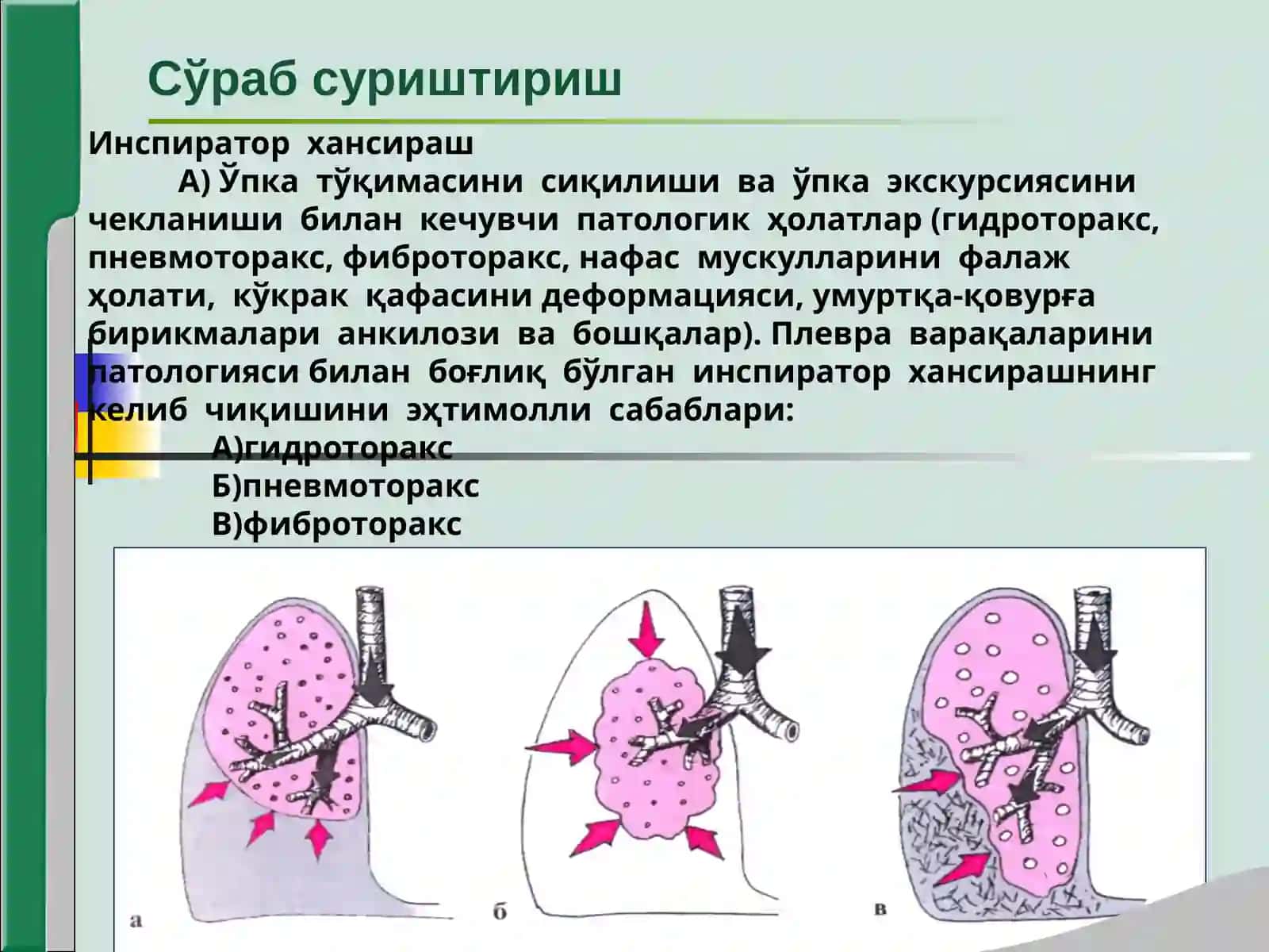 Нафас аъзолари касалликлари билан касалланган беморларни текшириш 4