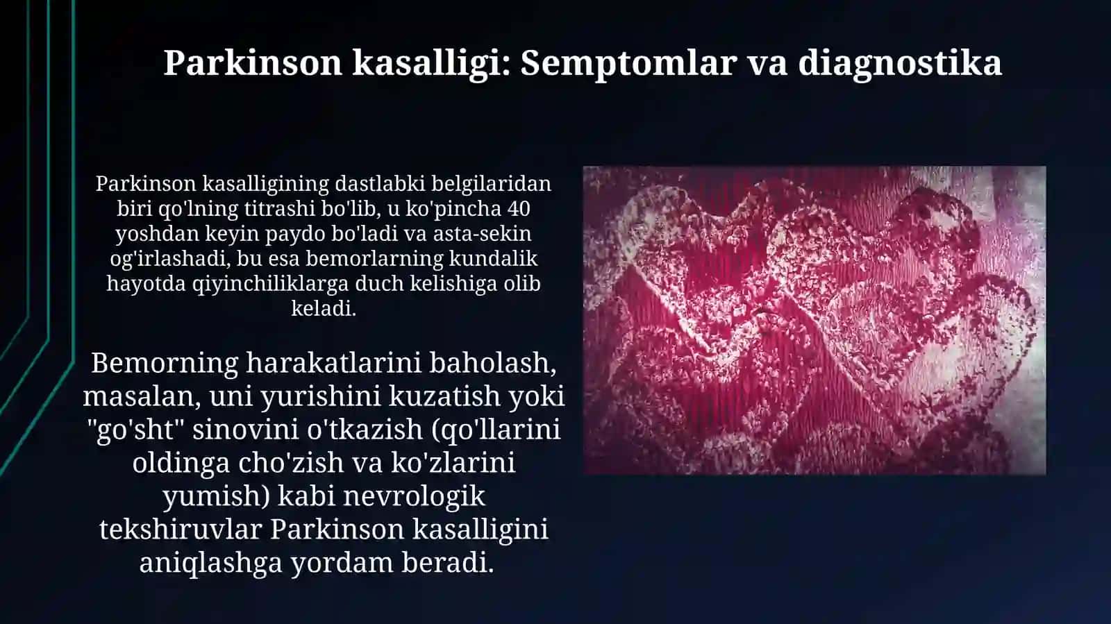 Altsgeymer va Parkinson kasalliklari 4