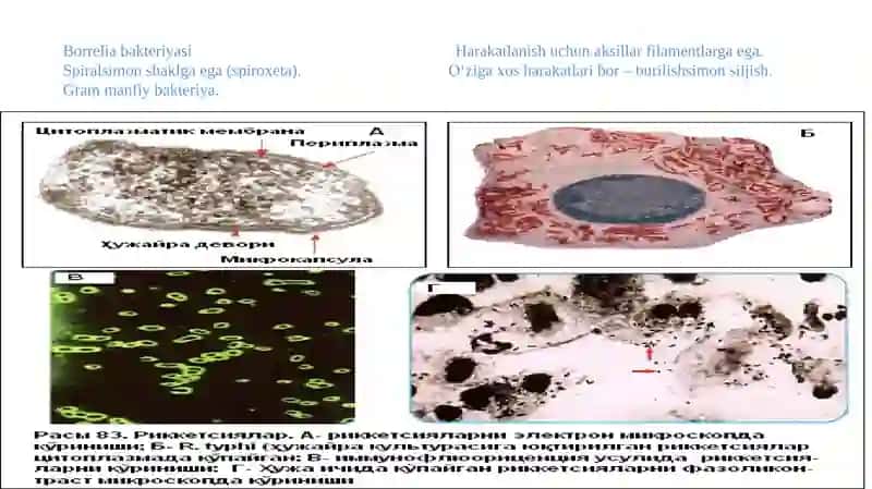 Borrelioz (Laym kasalligi) 4