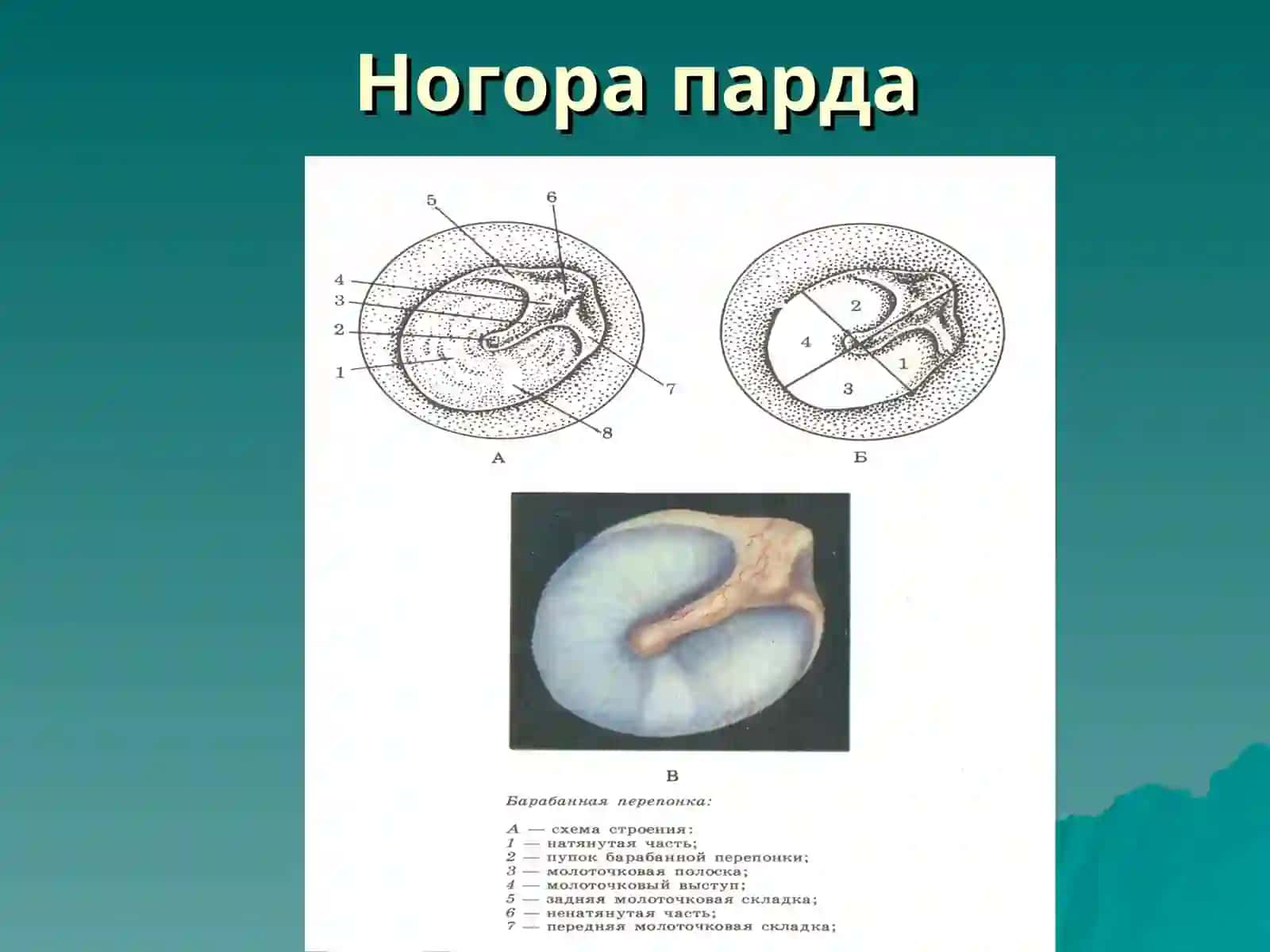 Ташки ва урта қулоқнинг уткир ва сурункали касалликлари 4
