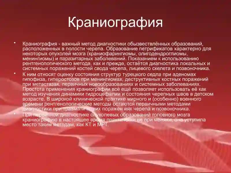 Методы лучевой диагностики в неврологии 4