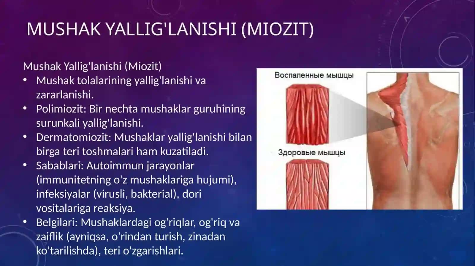 skelet mushaklari kasalliklari 4