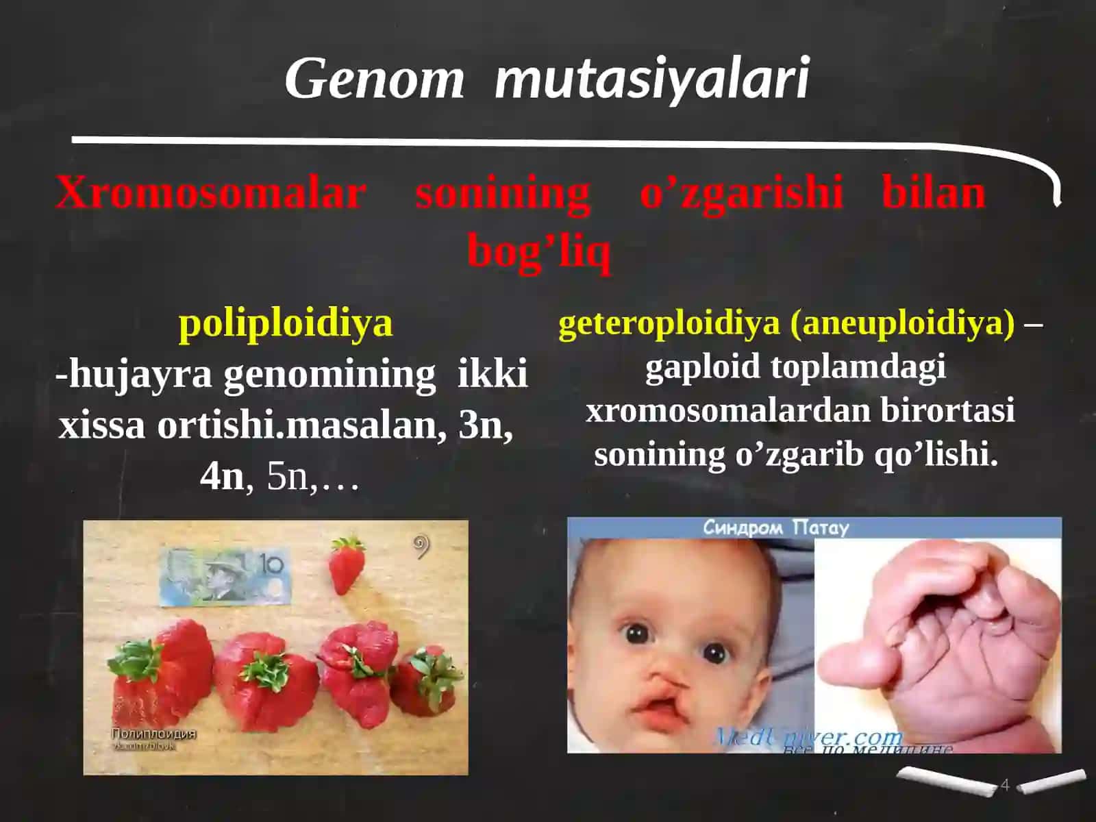 Odamda uchraydigan irsiy kasalliklar 4