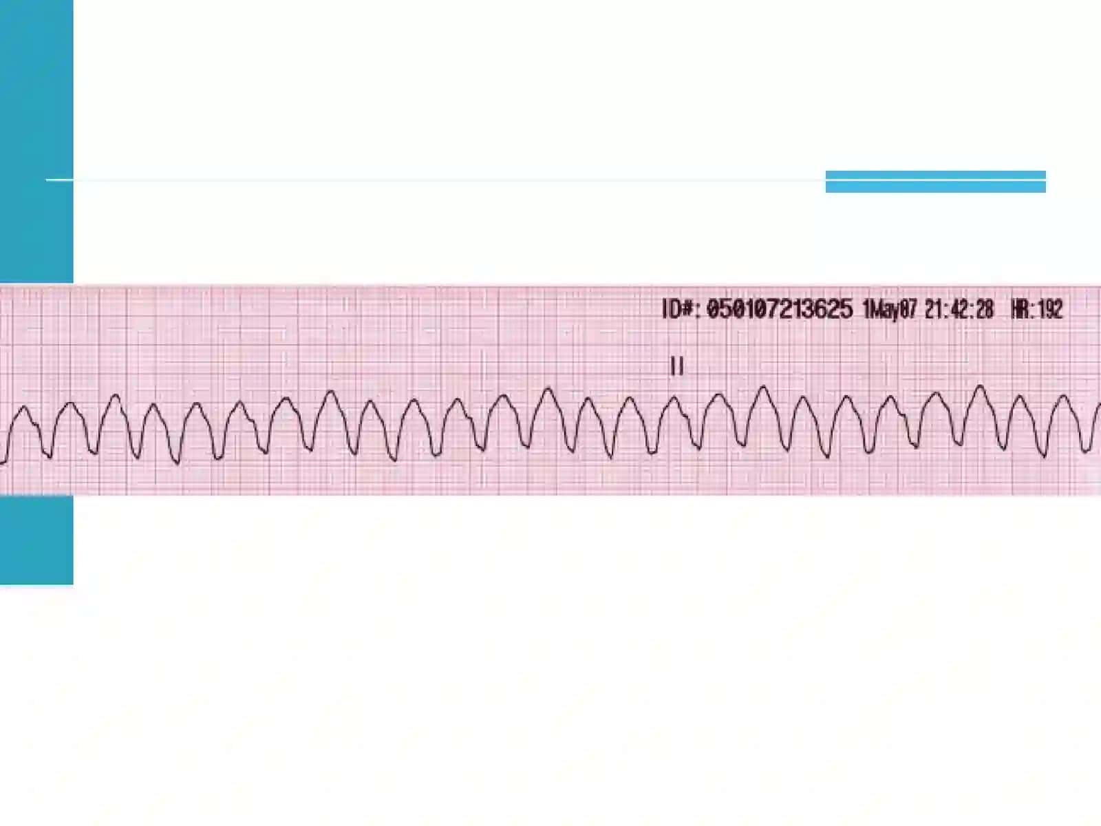 Advanced Cardiac Life Support 4