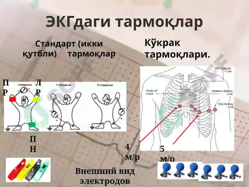 EKG ni yozib olish 5