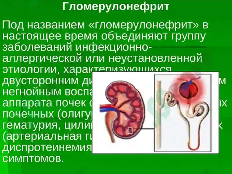 Болезни почек 5
