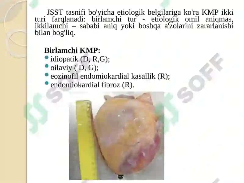 KARDIOMIOPATIYALAR 5
