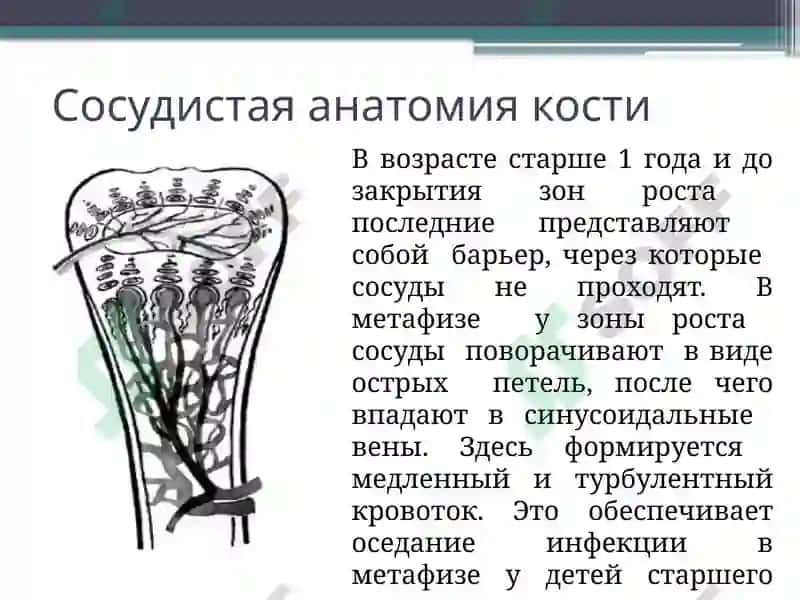 Острый гематогенный остеомиелит у детей 5