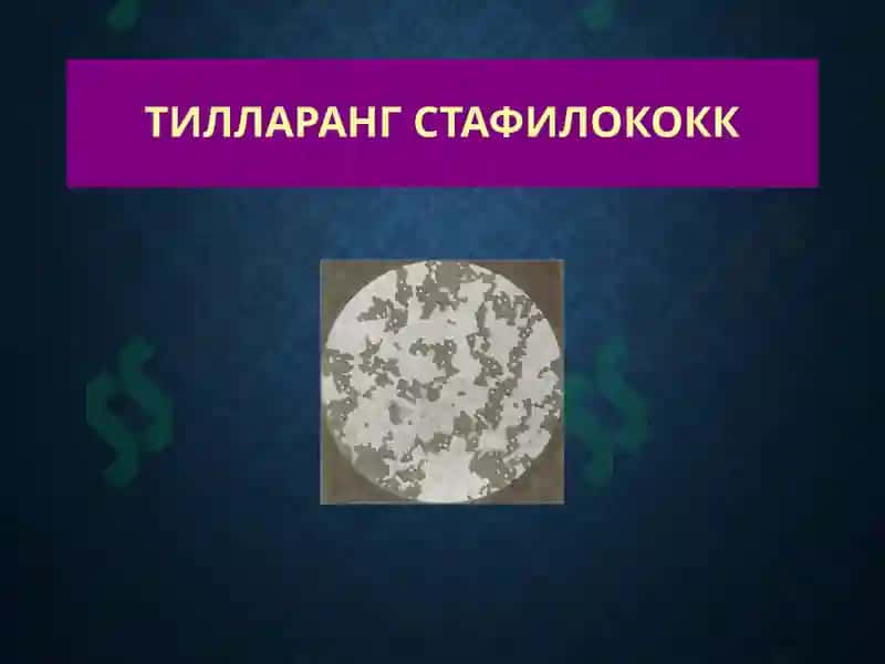 Терининг йирингли касалликлари-пиодермитлар 5