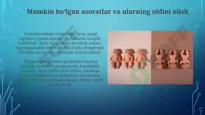 Ona va bola salomatligini ta'minlash 5