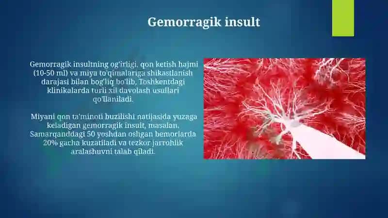 MRT angiografiyasi 5