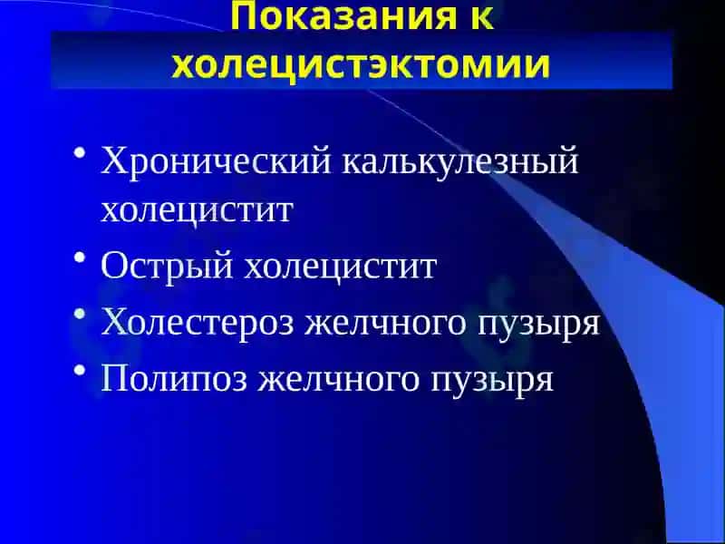 Постхолецистэктомический синдром 5