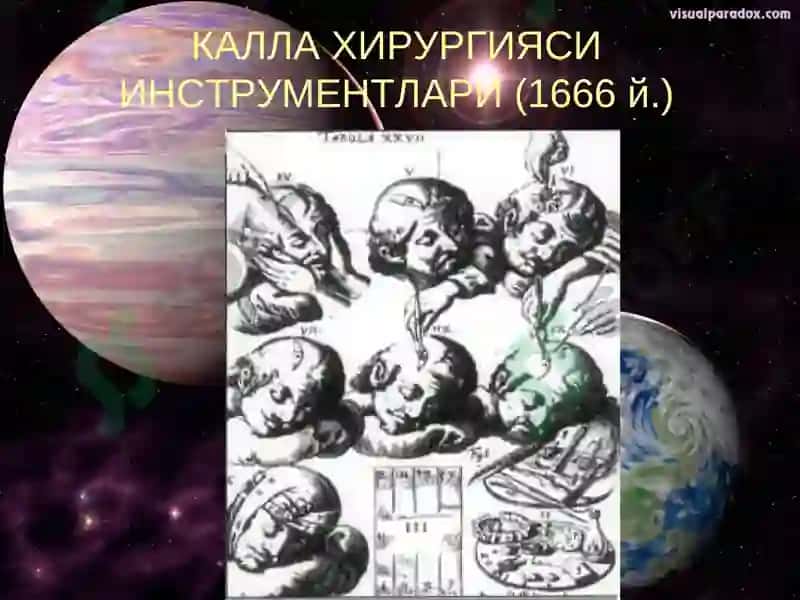 НЕЙРОХИРУРГИЯНИ РИВОЖЛАНИШ ТАРИХИ 5