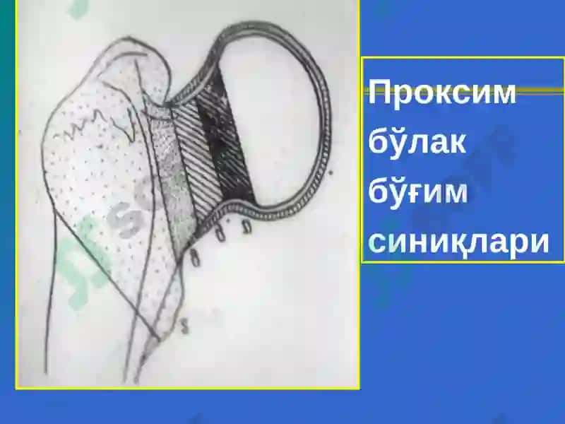 Сон,тизза,болдир ваоёқ панжа шикастлари 5