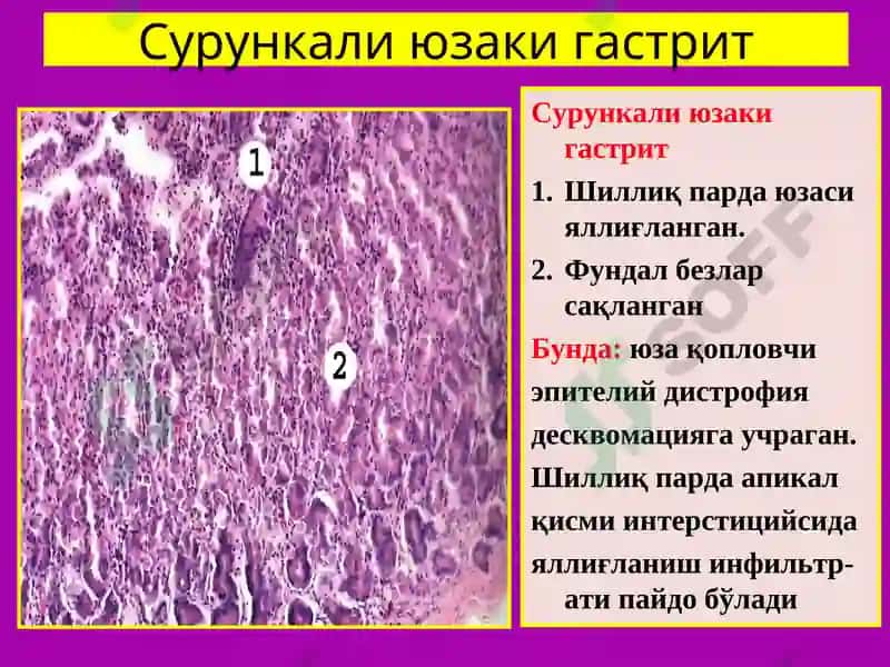 ПАТОЛОГИК АНАТОМИЯ 5