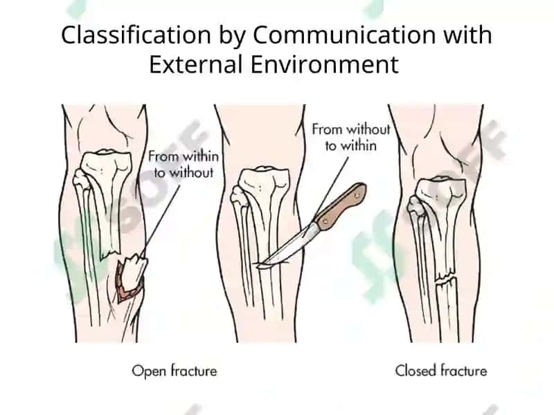 Fracture Management and Primary Care 5
