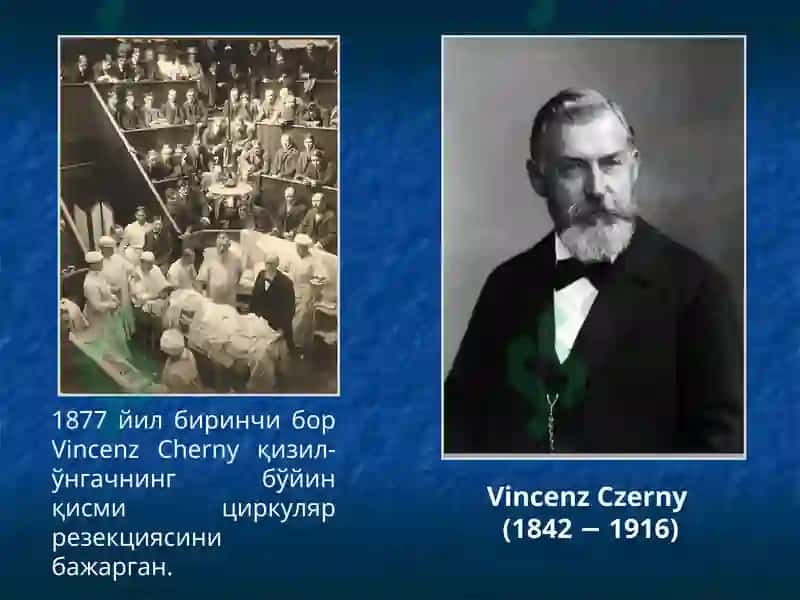 Қизилўнгач касалликлари 5
