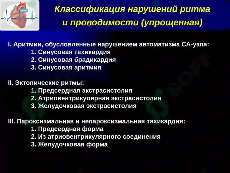 Нарушения ритма и проводимости 5