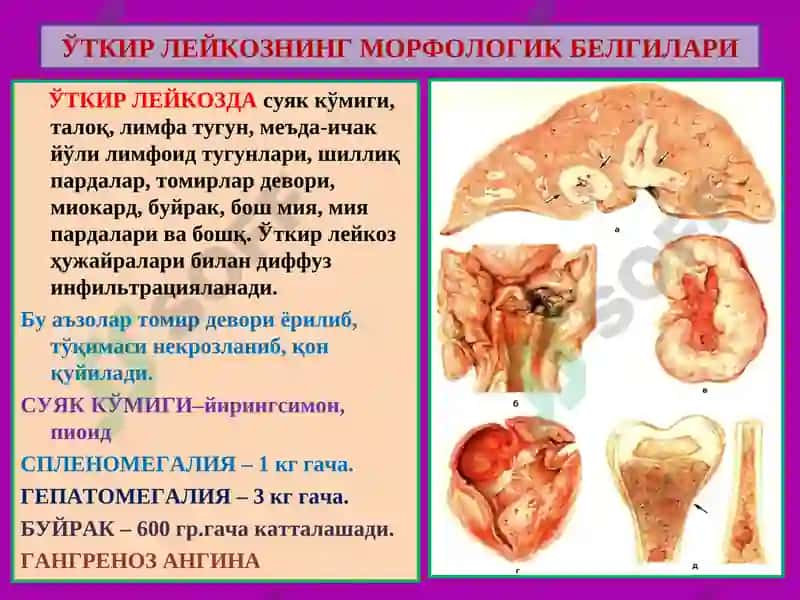 ПАТОЛОГИК АНАТОМИЯ 5