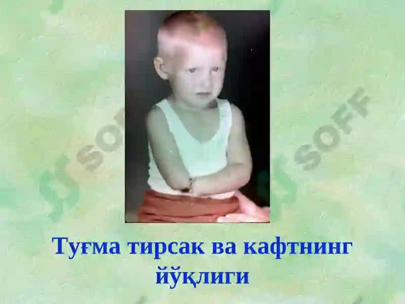 Туғма оёқ-қўл нуқсонлари 5